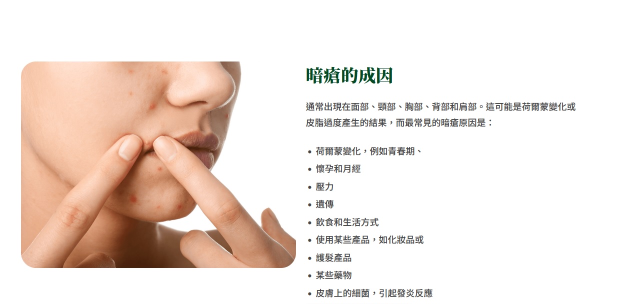 Hong Kong Traditional Chinese Medicine TCM Platform Latest TCM information: 養康中醫館醫暗瘡好唔好? 