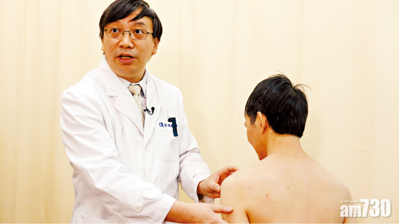 彭增福醫師Dr.PENG 媒體報導: 結合中西醫 有效率逾九成 激痛點針灸治筋膜痛